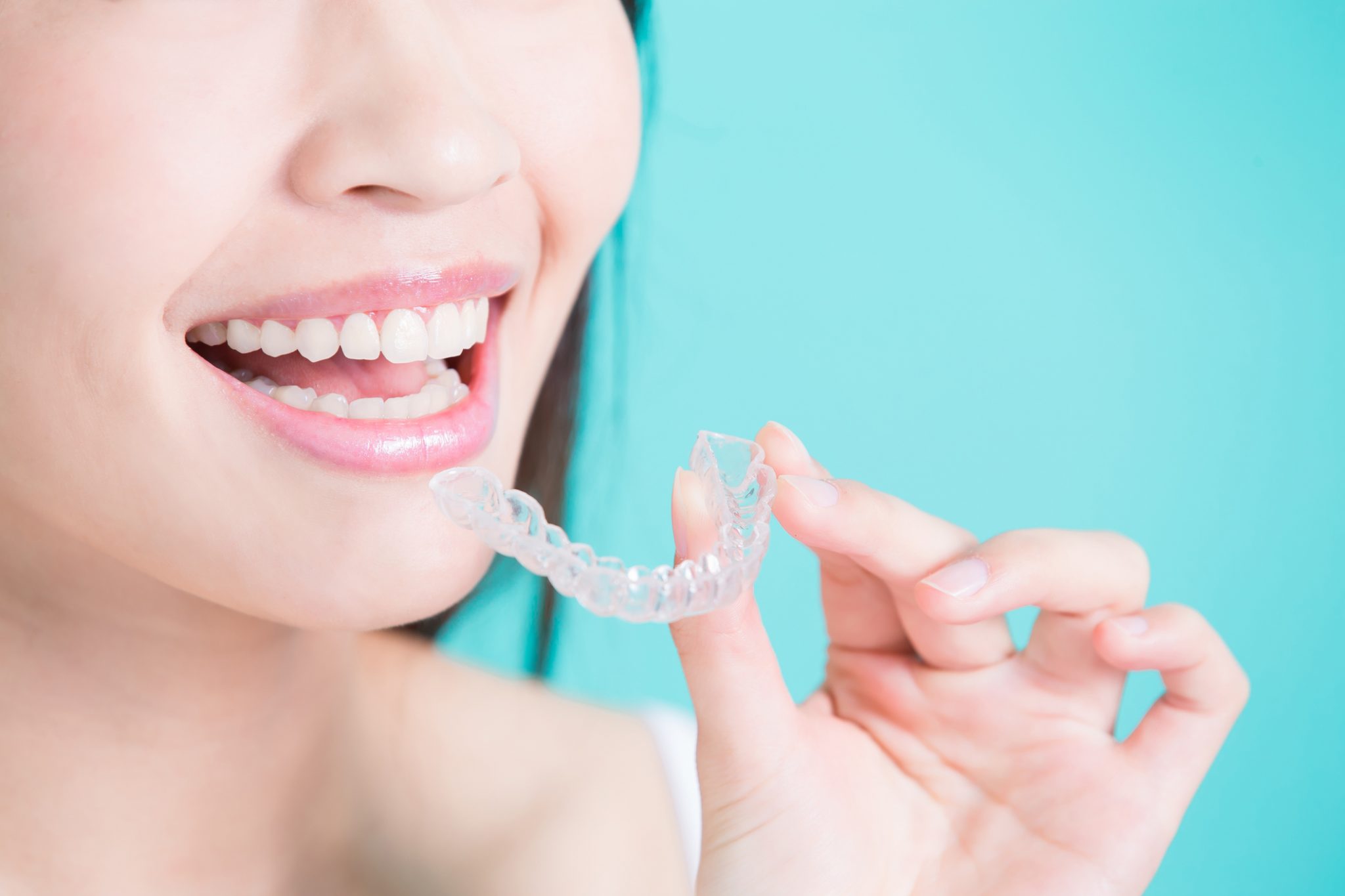 Does Invisalign Fix Overbites? Indianapolis 46203