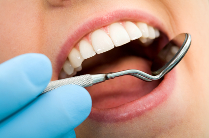 dental cleaning