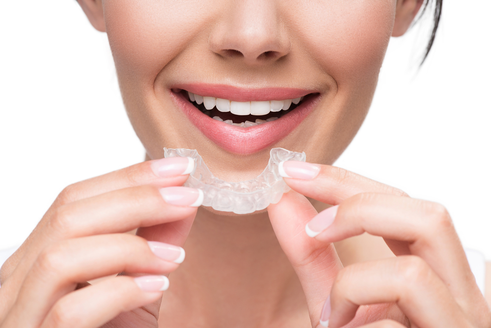 invisalign