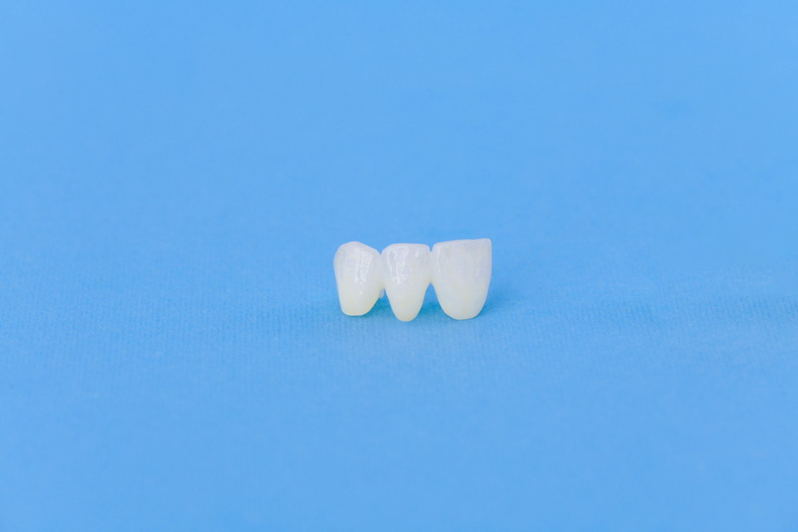 Why Are Dental Crowns Important, and Which Dentist Can Treat Me